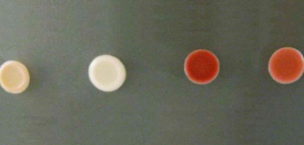 Yeast expression